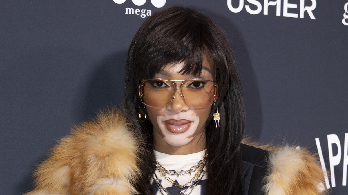 Winnie Harlow